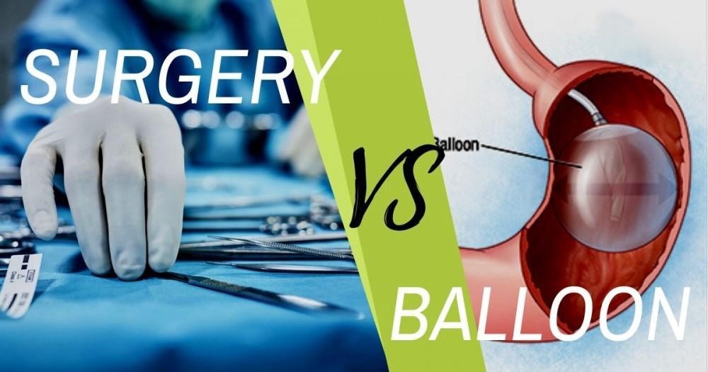 Mide Balonu mu, Obezite Cerrahisi mi? Hangi Tedavi Sizin İçin Daha Uygun Olabilir?