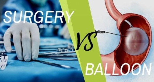 Mide Balonu mu, Obezite Cerrahisi mi? Hangi Tedavi Sizin İçin Daha Uygun Olabilir?