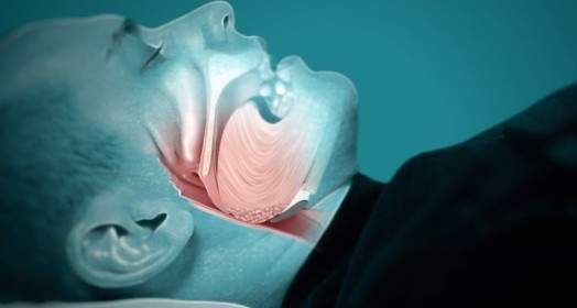 Obezite ve Uyku Apnesi Arasındaki Bağlantı Nedir?