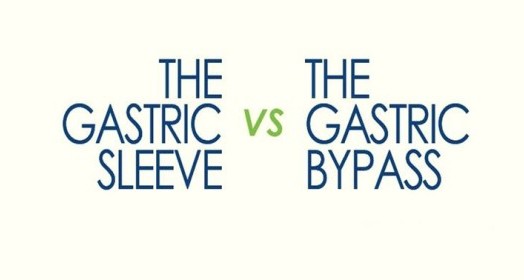 Tüp Mide ve Gastrik By-Pass Arasındaki Fark Nedir?