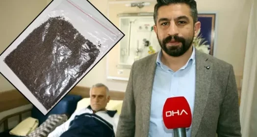 Safra kesesinden 14 bin 387 taş çıktı, Guinness’e başvuru yapıldı