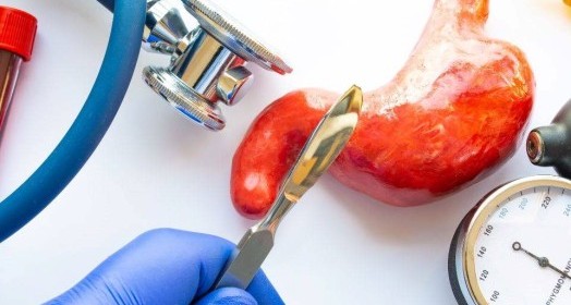 Revizyon Ameliyatı Nedir? İstanbul Obezite Cerrahisinde Yeni Dönem