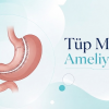 Tüp Mide Ameliyatı