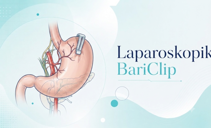 Laparoskopik Bariclip