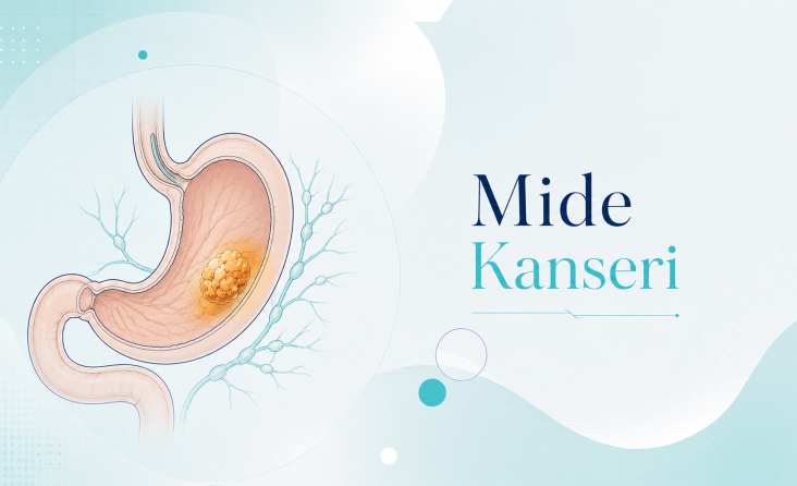 Mide Kanseri