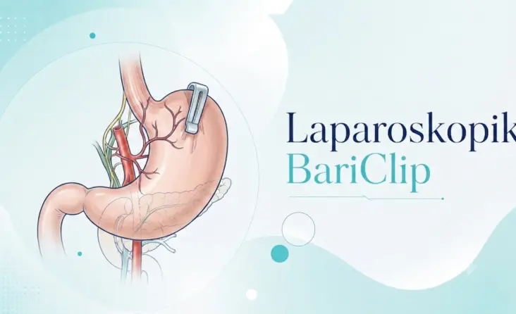 Laparoskopik Bariclip tedavisi