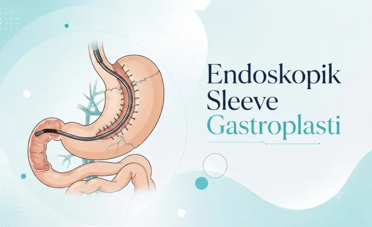Endoskopik Sleeve Gastroplasti tedavisi