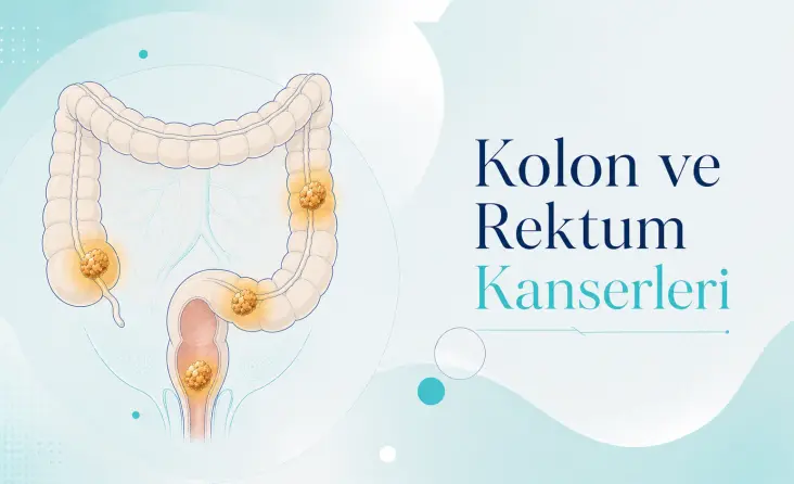 Kolon Kanseri tedavisi