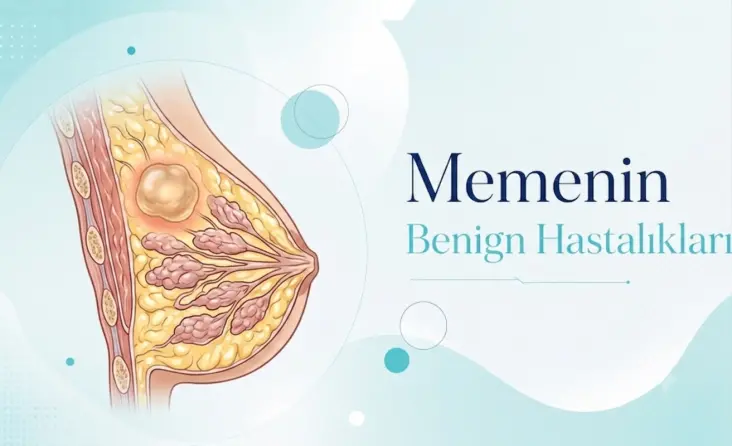 Memenin Benign (iyi huylu) Hastalıkları tedavisi