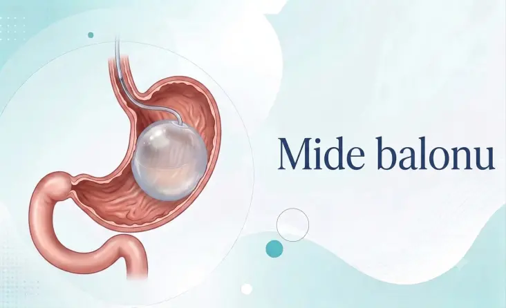 Mide Balonu tedavisi