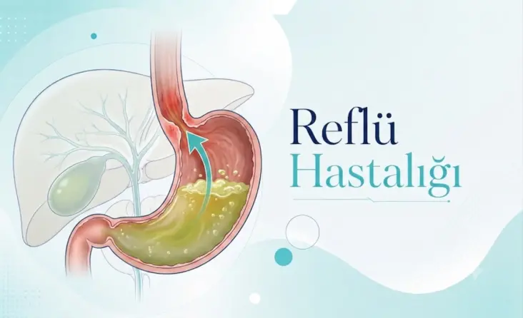 Reflü Hastalığı tedavisi