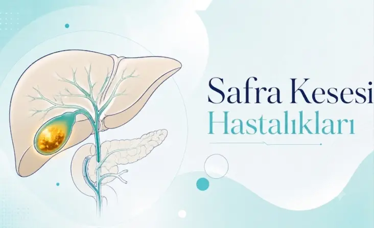 Safra Kesesi Hastalıkları tedavisi