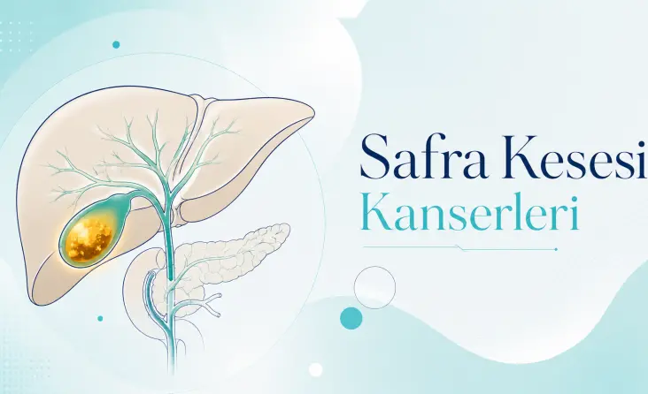 Safra Kesesi Kanserleri tedavisi