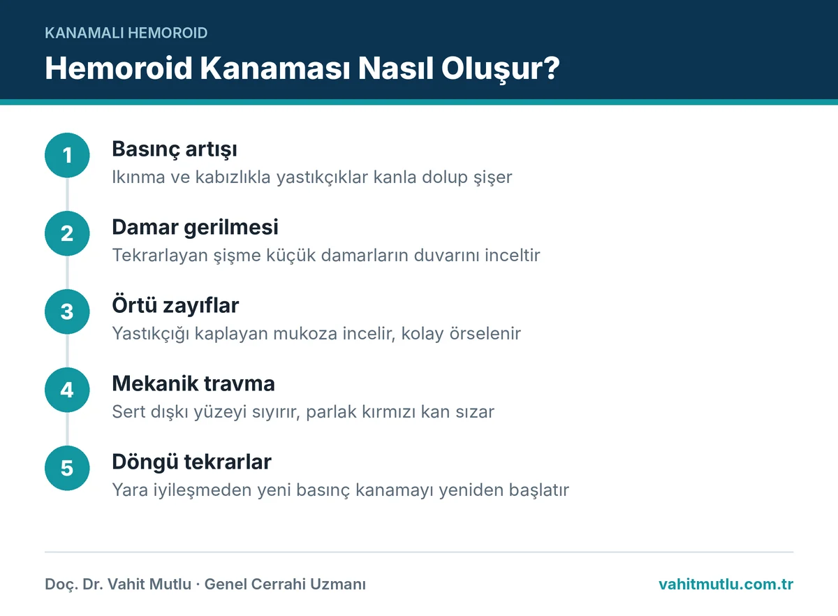 Basurdan neden kan gelir sorusunu basınç artışından mekanik travmaya beş adımda anlatan kanama mekanizması şeması