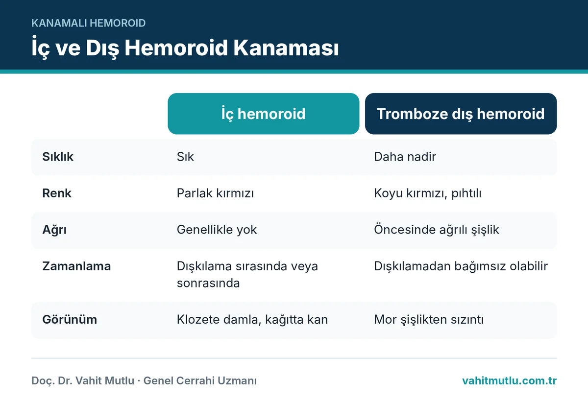 Dış hemoroid kanamasını iç hemoroid kanamasından renk, ağrı, zamanlama ve görünüm açısından ayıran karşılaştırma tablosu