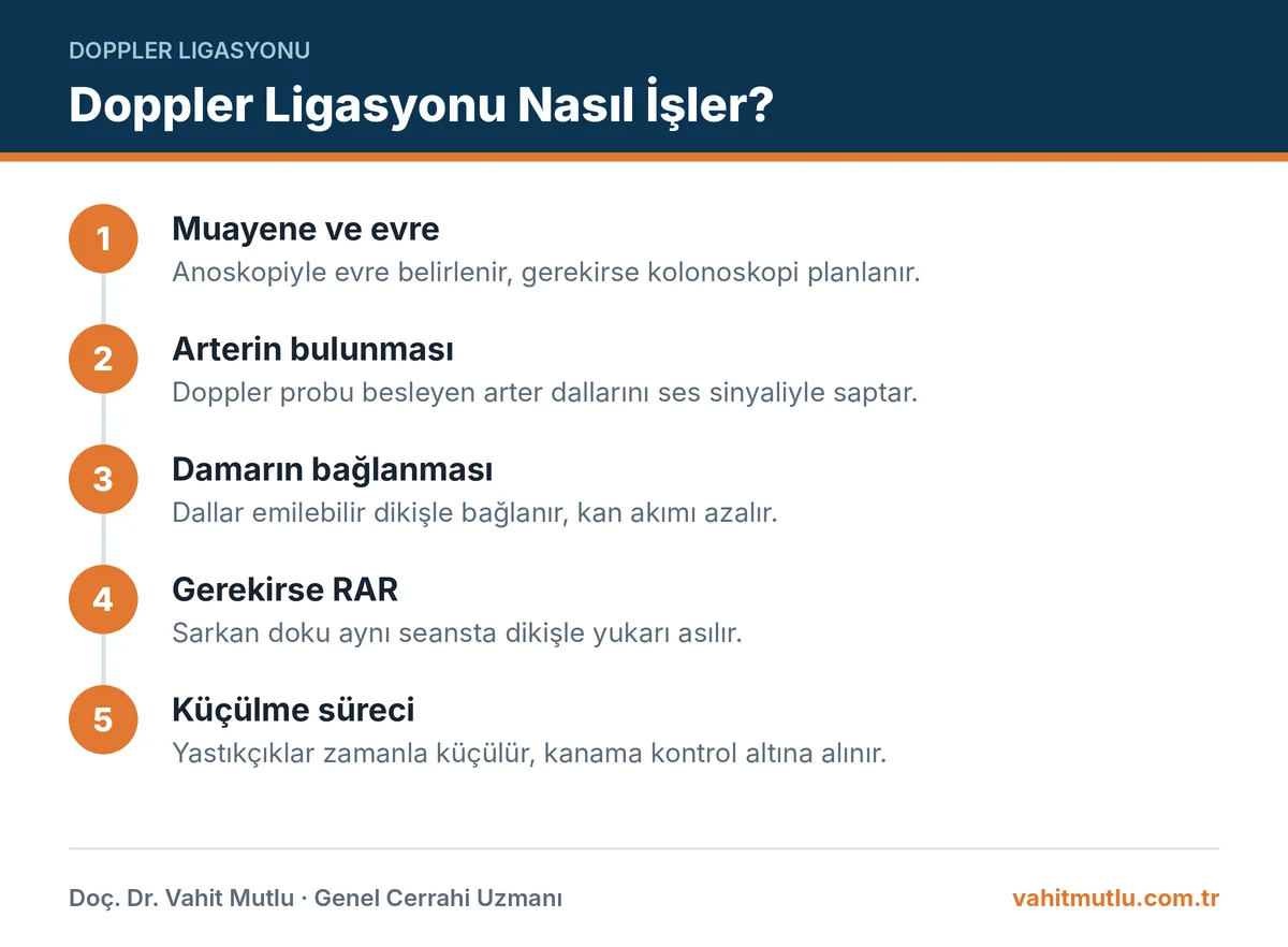 Doppler ligasyonu sık sorulan sorular özeti: arterin Doppler ile bulunması, bağlanması, RAR ve küçülme
