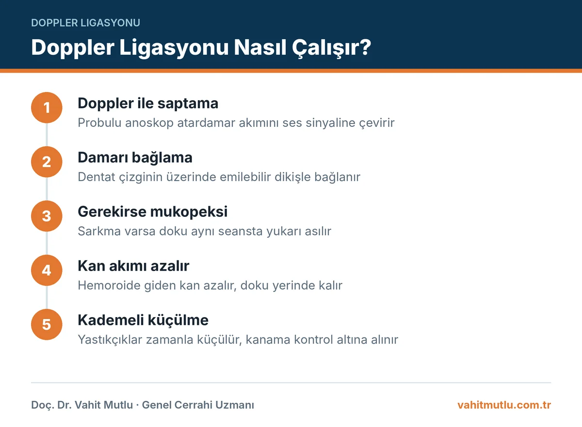 Hemoroid doppler ligasyonunda damarın sesle bulunması, dikişle bağlanması ve hemoroidin zamanla küçülmesini gösteren adımlar
