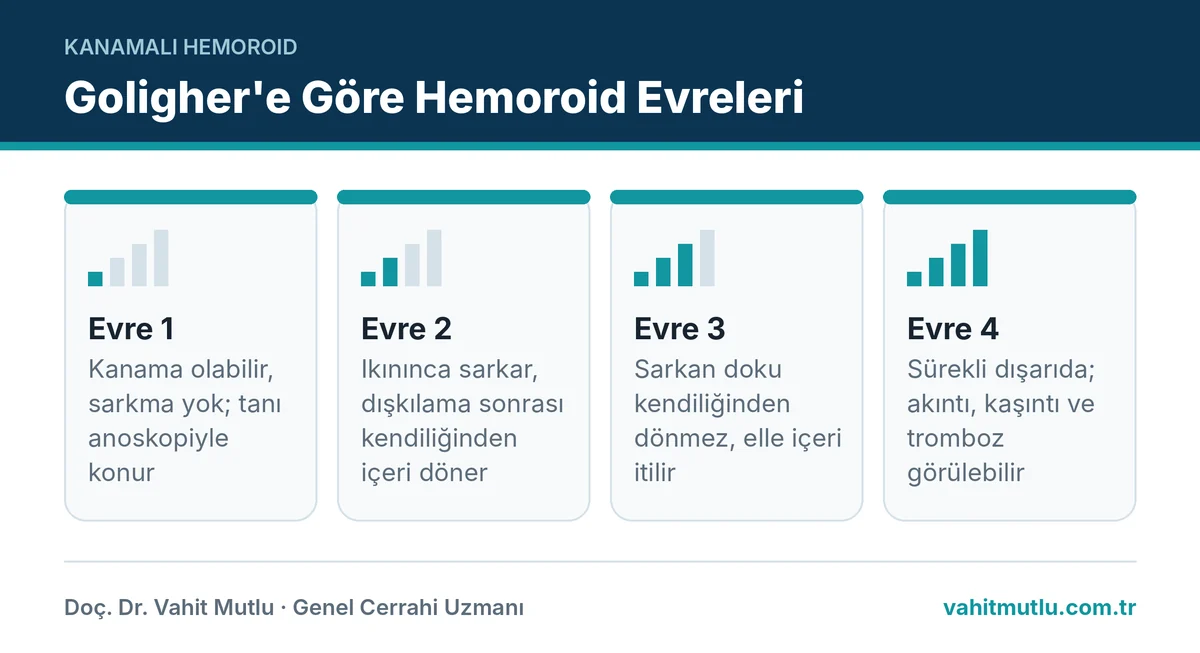 Hemoroid evreleri kanama ve sarkma: evre 1 sarkmasız, evre 2 kendiliğinden dönen, evre 3 elle itilen, evre 4 dışarıda
