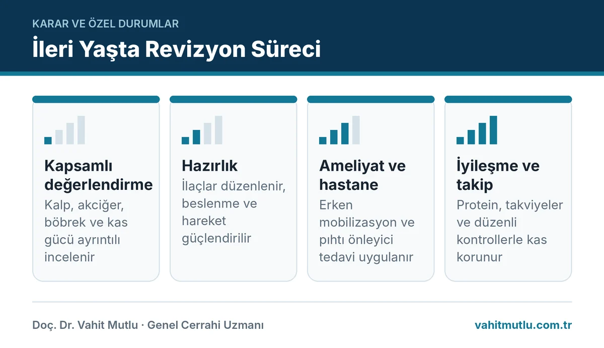 İleri yaşta revizyon sürecinin dört aşamasını gösteren infografik