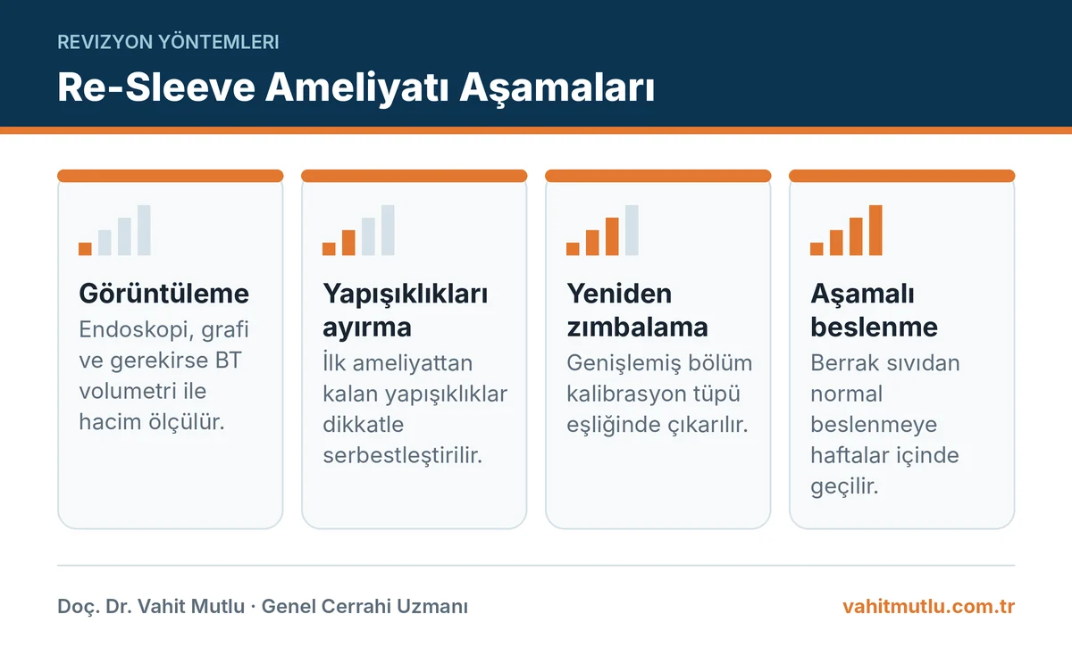 Re-sleeve ameliyatı sürecini tetkikten takibe dört aşamada özetleyen infografik