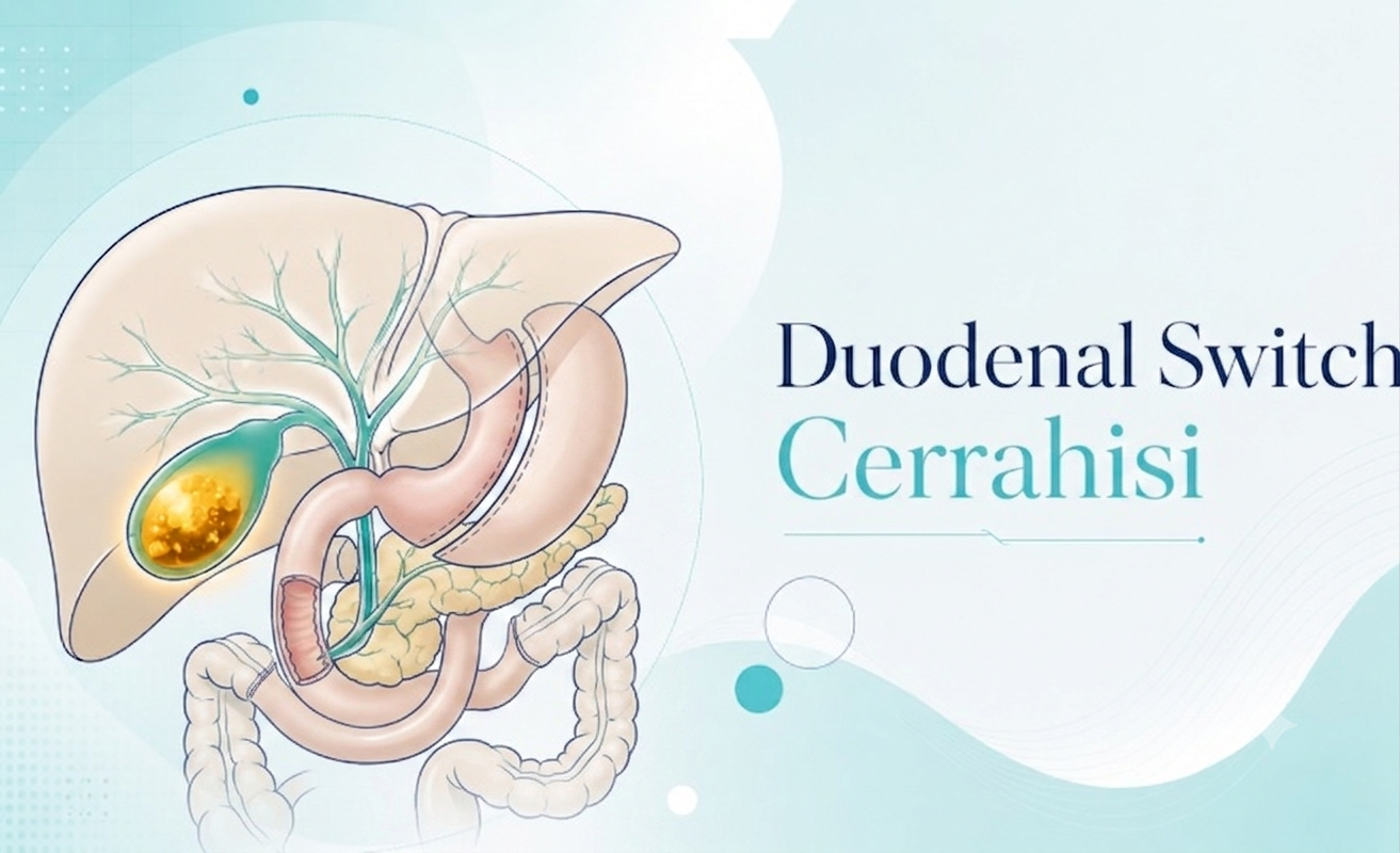 Duodenal Switch — Doç. Dr. Vahit Mutlu