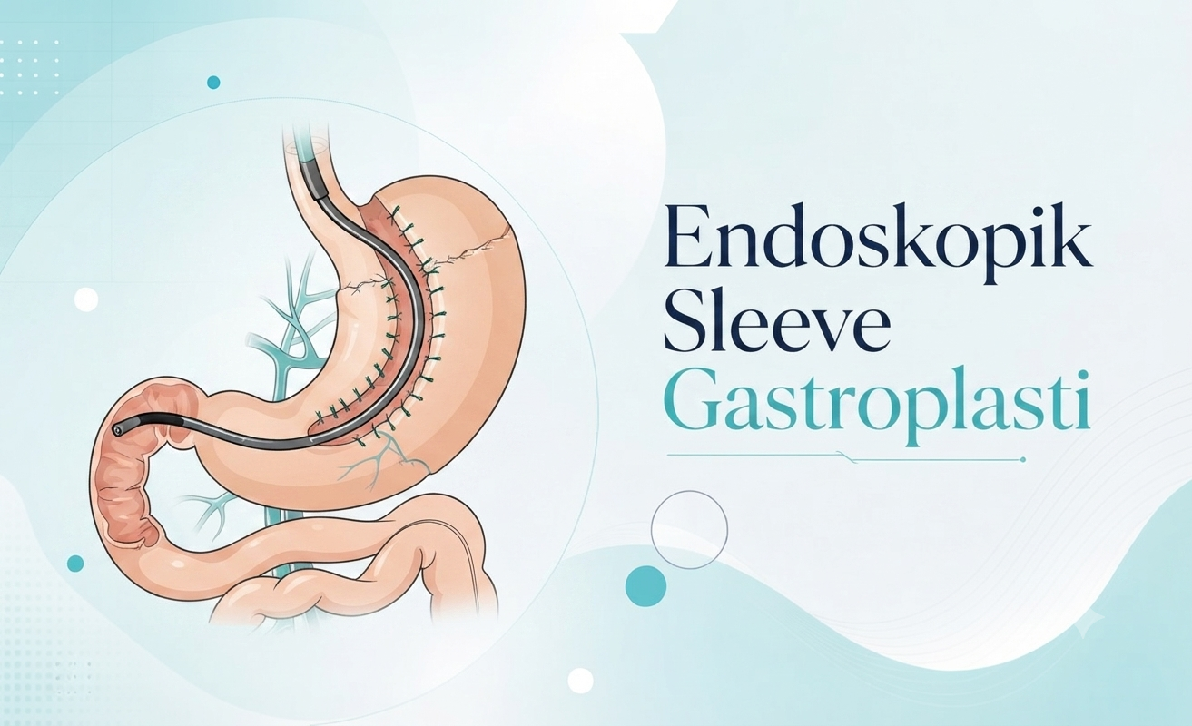 Endoskopik Sleeve Gastroplasti — Doç. Dr. Vahit Mutlu