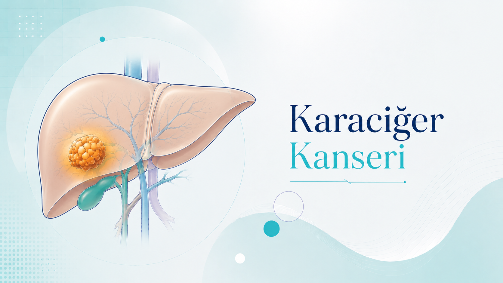 Karaciğer Kanseri