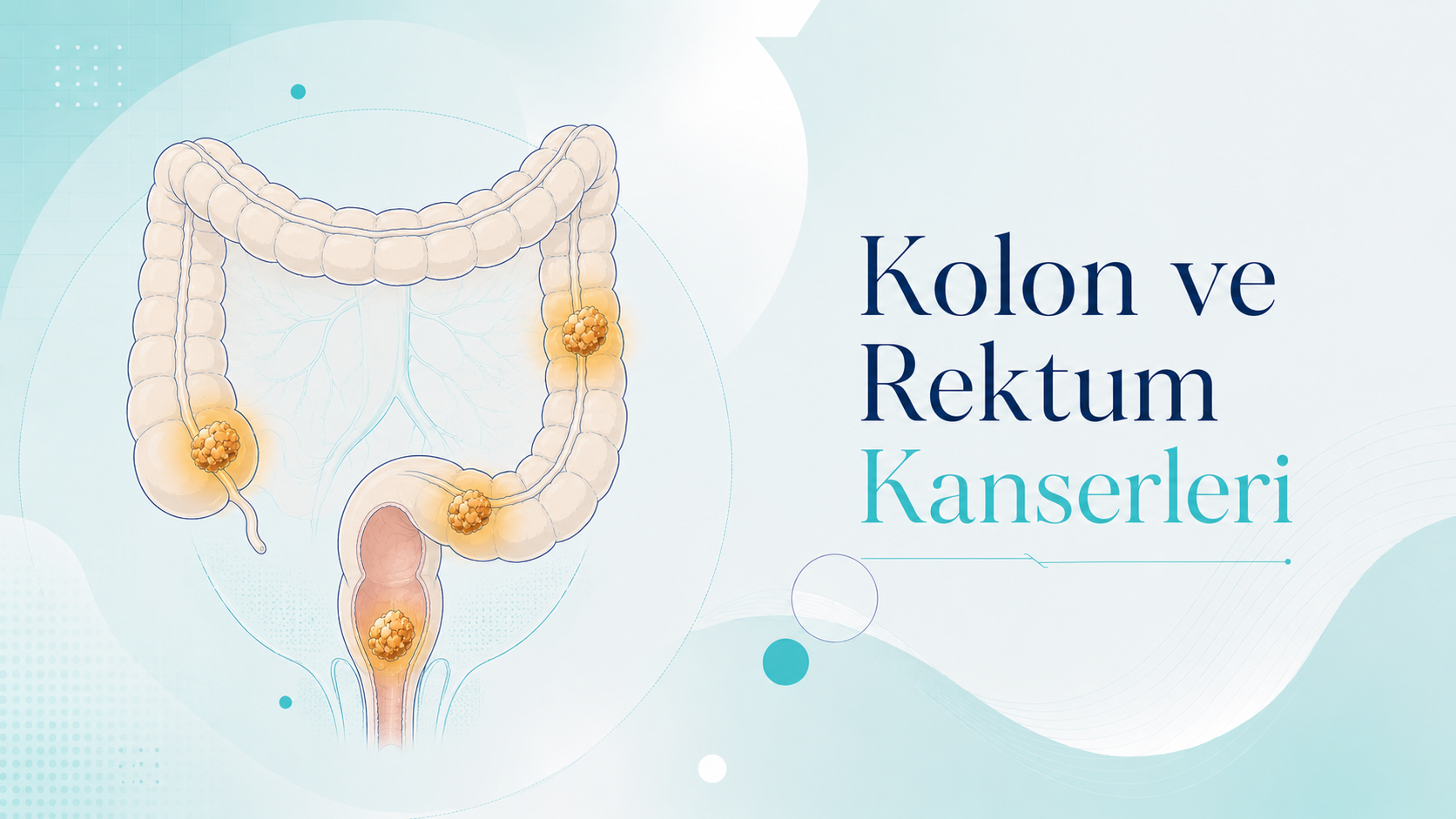 Kolon ve Rektum Kanserleri