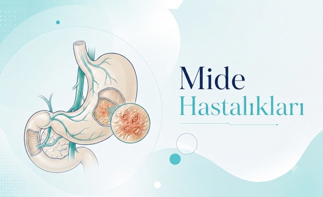 Mide Hastalıkları