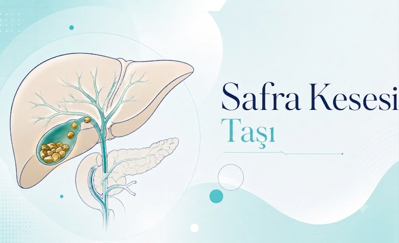 Safra Kesesi Taşı — Doç. Dr. Vahit Mutlu