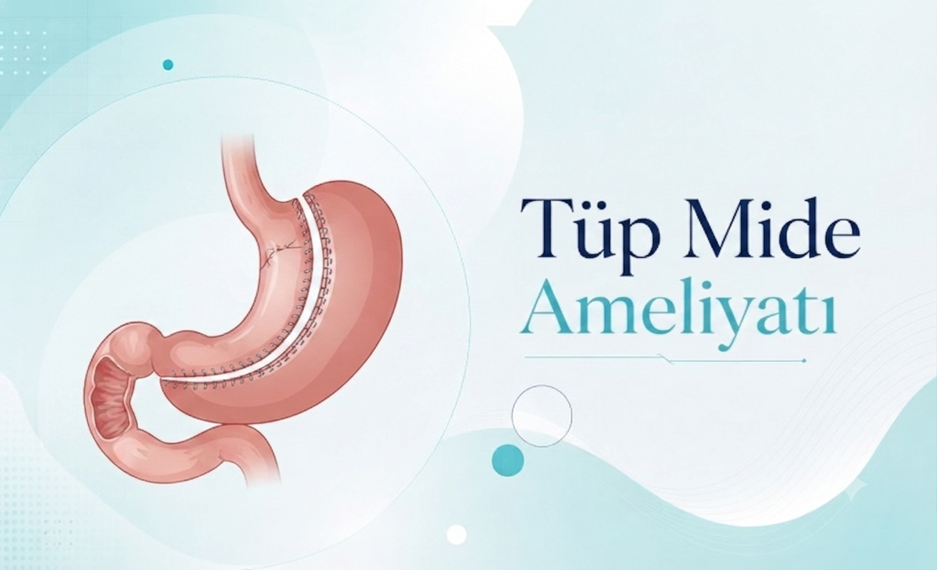 Tüp Mide Ameliyatı